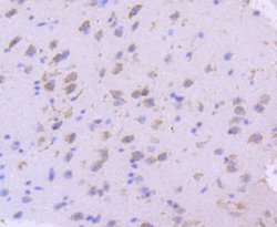 Invitrogen SGK1 Recombinant Rabbit Monoclonal Antibody (SC05-71) 100 &mu;L;