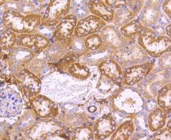 Invitrogen SGK1 Recombinant Rabbit Monoclonal Antibody (SC05-71) 100 &mu;L;
