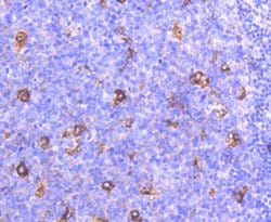 Invitrogen APOE Recombinant Rabbit Monoclonal Antibody (SC0536) 100 &mu;L;
