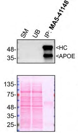 Invitrogen APOE Recombinant Rabbit Monoclonal Antibody (SC0536) 100 &mu;L;