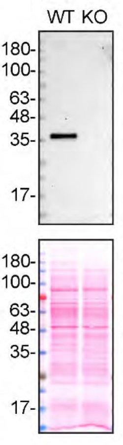 Invitrogen APOE Recombinant Rabbit Monoclonal Antibody (SC0536) 100 &mu;L;