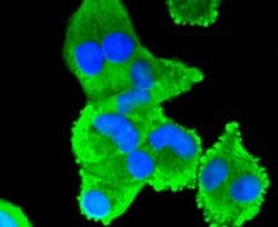 Invitrogen COX2 Recombinant Rabbit Monoclonal Antibody (SC56-06) 100 &mu;L;