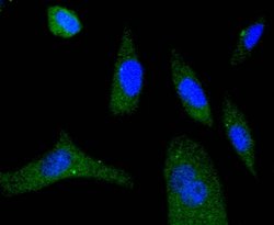 Invitrogen Phospho-eIF4E (Ser209) Recombinant Rabbit Monoclonal Antibody