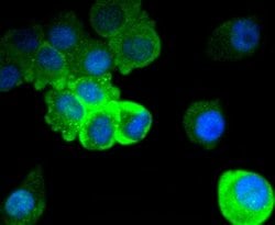 Invitrogen Phospho-Tau (Ser396) Recombinant Rabbit Monoclonal Antibody