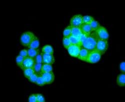 Invitrogen Phospho-Tau (Ser396) Recombinant Rabbit Monoclonal Antibody