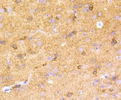 Invitrogen Phospho-Tau (Ser396) Recombinant Rabbit Monoclonal Antibody