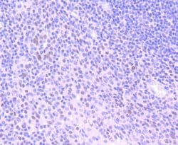 Invitrogen HDAC3 Recombinant Rabbit Monoclonal Antibody (SC55-02) 100 &mu;L | Buy Online | Invitrogen&trade; | Fisher Scientific