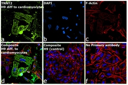 Invitrogen Cardiac Troponin T Recombinant Rabbit Monoclonal Antibody (SC64-03)