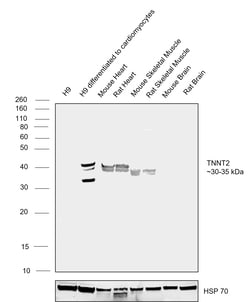 Invitrogen Cardiac Troponin T Recombinant Rabbit Monoclonal Antibody (SC64-03)