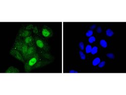 Invitrogen STAT5 alpha Recombinant Rabbit Monoclonal Antibody (SC66-09)