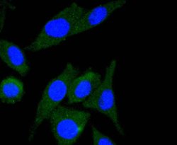 Invitrogen ILK Recombinant Rabbit Monoclonal Antibody (SC68-04) 100 &mu;L;