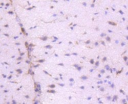 Invitrogen ILK Recombinant Rabbit Monoclonal Antibody (SC68-04) 100 &mu;L;