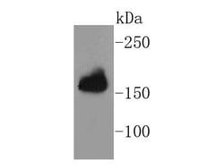 Invitrogen Protein APC Recombinant Rabbit Monoclonal Antibody (SC61-03) 100 &mu;L | Buy Online | Invitrogen&trade; | Fisher Scientific