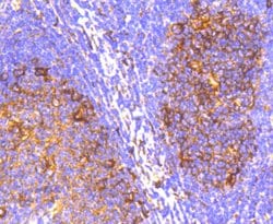 Invitrogen IRF7 Recombinant Rabbit Monoclonal Antibody (SC0617) 100 &mu;L;