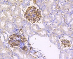 Invitrogen IRF7 Recombinant Rabbit Monoclonal Antibody (SC0617) 100 &mu;L;