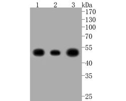 Invitrogen NSE Recombinant Rabbit Monoclonal Antibody (SC06-28) 100 &mu;L | Buy Online | Invitrogen&trade; | Fisher Scientific