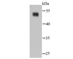 Invitrogen NSE Recombinant Rabbit Monoclonal Antibody (SC06-28) 100 &mu;L | Buy Online | Invitrogen&trade; | Fisher Scientific