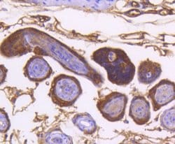 Invitrogen IKK alpha Recombinant Rabbit Monoclonal Antibody (SN06-99) 100