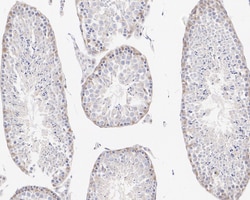 Invitrogen SHP2 Recombinant Rabbit Monoclonal Antibody (SN72-02) 100 &mu;L;
