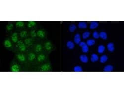 Invitrogen Phospho-SMAD3 (Ser423, Ser425) Recombinant Rabbit Monoclonal