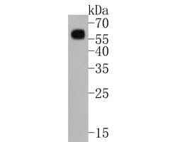 Invitrogen Phospho-SMAD3 (Ser423, Ser425) Recombinant Rabbit Monoclonal