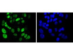 Invitrogen SOX9 Recombinant Rabbit Monoclonal Antibody (SN74-09) 100 &mu;L;