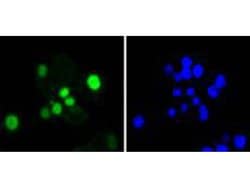 Invitrogen SOX9 Recombinant Rabbit Monoclonal Antibody (SN74-09) 100 &mu;L;