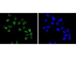 Invitrogen&trade;&nbsp;BRG1 Recombinant Rabbit Monoclonal Antibody (SN20-03)