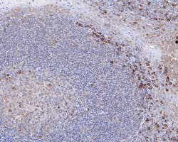 Invitrogen IRF5 Recombinant Rabbit Monoclonal Antibody (SN201-05) 100 &mu;L;