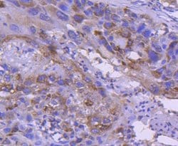 Invitrogen IRF5 Recombinant Rabbit Monoclonal Antibody (SN201-05) 100 &mu;L;