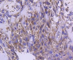 Invitrogen IRF5 Recombinant Rabbit Monoclonal Antibody (SN201-05) 100 &mu;L;