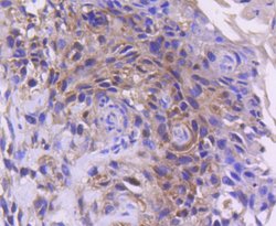 Invitrogen CDK4 Recombinant Rabbit Monoclonal Antibody (SD20-42) 100 &mu;L;