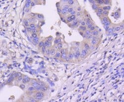 Invitrogen CDK4 Recombinant Rabbit Monoclonal Antibody (SD20-42) 100 &mu;L;
