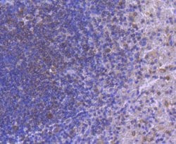 Invitrogen IRF5 Recombinant Rabbit Monoclonal Antibody (SD203-07) 100 &mu;L | Buy Online | Invitrogen&trade; | Fisher Scientific