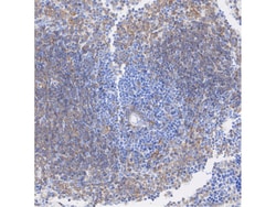 Invitrogen IRF5 Recombinant Rabbit Monoclonal Antibody (SD203-07) 100 &mu;L | Buy Online | Invitrogen&trade; | Fisher Scientific