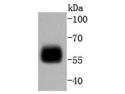 Invitrogen IRF5 Recombinant Rabbit Monoclonal Antibody (SD203-07) 100 &mu;L | Buy Online | Invitrogen&trade; | Fisher Scientific