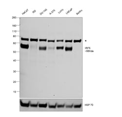 Invitrogen IRF5 Recombinant Rabbit Monoclonal Antibody (SD203-07) 100 &mu;L | Buy Online | Invitrogen&trade; | Fisher Scientific