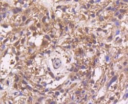 Invitrogen MEK3 Recombinant Rabbit Monoclonal Antibody (SD20-93) 100 &mu;L;