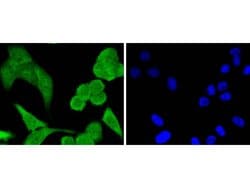 Invitrogen STAT1 Recombinant Rabbit Monoclonal Antibody (SD20-75) 100 &mu;L;