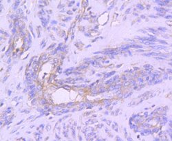 Invitrogen STAT1 Recombinant Rabbit Monoclonal Antibody (SD20-75) 100 &mu;L;