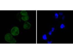 Invitrogen CDK4 Recombinant Rabbit Monoclonal Antibody (SD205-1) 100 &mu;L;