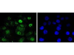 Invitrogen CDK4 Recombinant Rabbit Monoclonal Antibody (SD205-1) 100 &mu;L;