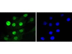 Invitrogen CDK4 Recombinant Rabbit Monoclonal Antibody (SD205-1) 100 &mu;L;