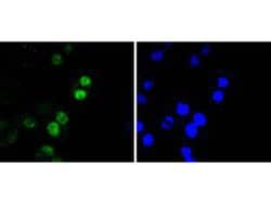 Invitrogen RUNX2 Recombinant Rabbit Monoclonal Antibody (SD208-0) 100 &mu;L;