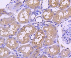 Invitrogen TRAF2 Recombinant Rabbit Monoclonal Antibody (SD205-06) 100