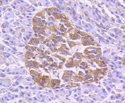 Invitrogen TRAF2 Recombinant Rabbit Monoclonal Antibody (SD205-06) 100