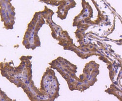 Invitrogen TRAF2 Recombinant Rabbit Monoclonal Antibody (SD205-06) 100