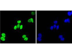 Invitrogen JunB Recombinant Rabbit Monoclonal Antibody (SD081-08) 100 &mu;L | Buy Online | Invitrogen&trade; | Fisher Scientific