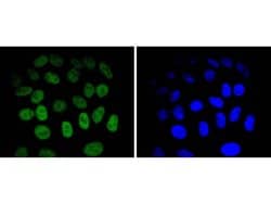 Invitrogen JunB Recombinant Rabbit Monoclonal Antibody (SD081-08) 100 &mu;L | Buy Online | Invitrogen&trade; | Fisher Scientific