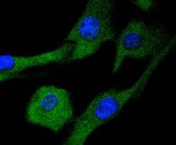 MEK2 Recombinant Rabbit Monoclonal Antibody (SD207-08):Antibodies, Recombinant
